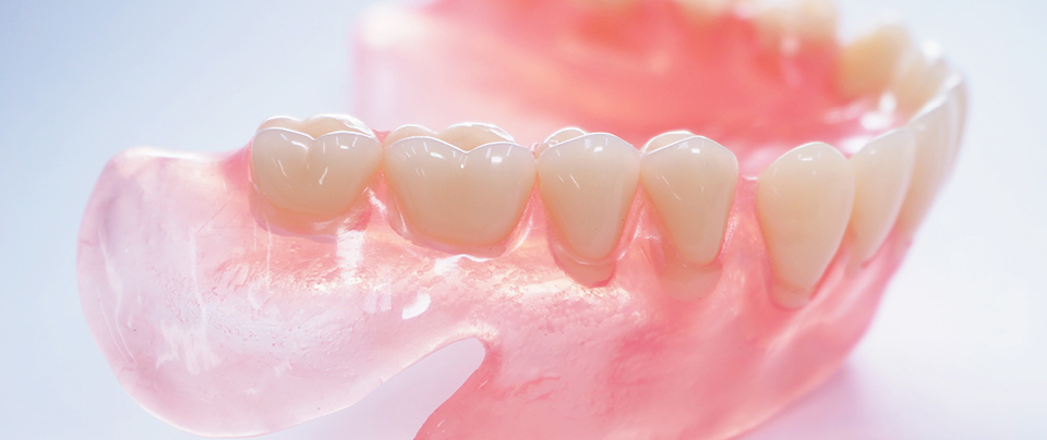 インプラントオーバーデンチャー