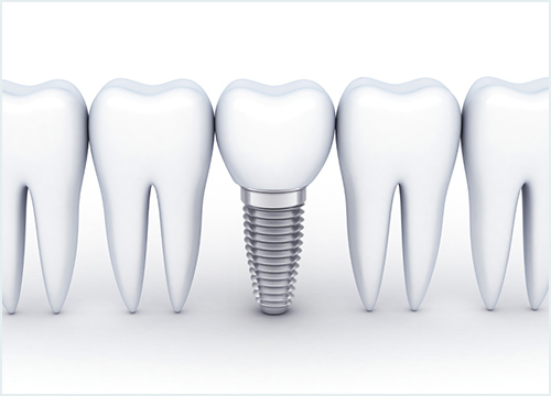 ノーベルガイド